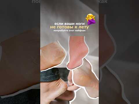 Как восстановить пятки за 1 ночь WB #205074596 #трещинынапятках #уходзателом