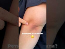 Если темные локти🤔Сыворотка арт. 142054897 #локти #ретинол #кожа #уходзакожей #уходзателом РП