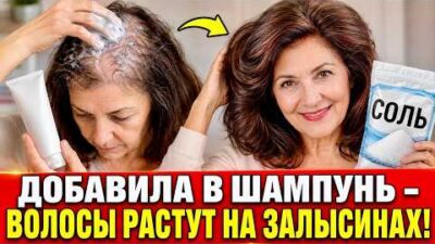 ДОБАВИЛА ЭТО В ШАМПУНЬ … Волосы растут как сумасшедшие даже на залысинах ! Стали гуще в 3 раза