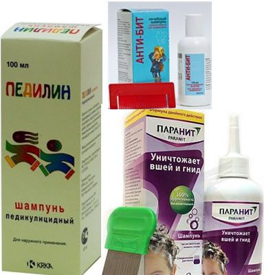как избавиться от вшей и гнид шампунь