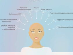 Причины выпадения волос у женщин